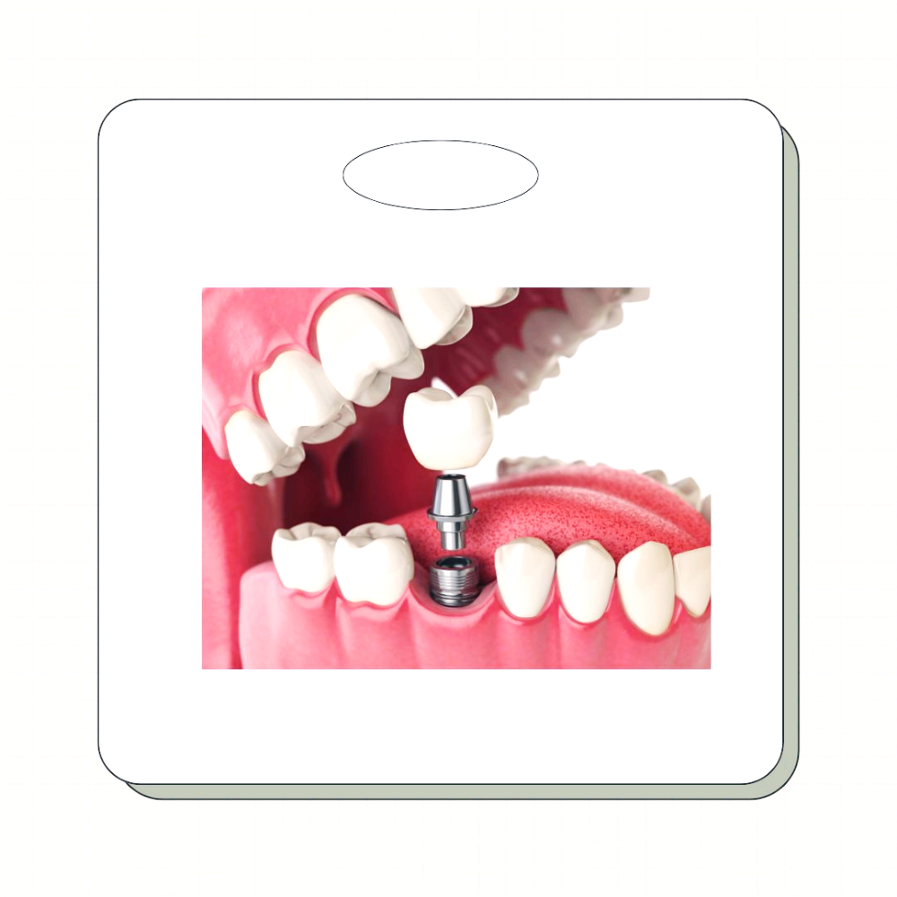 고령자 임플란트 건강보험 