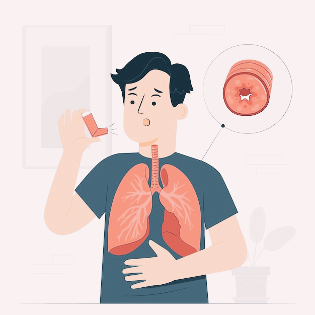 보스웰리아 효능 부작용