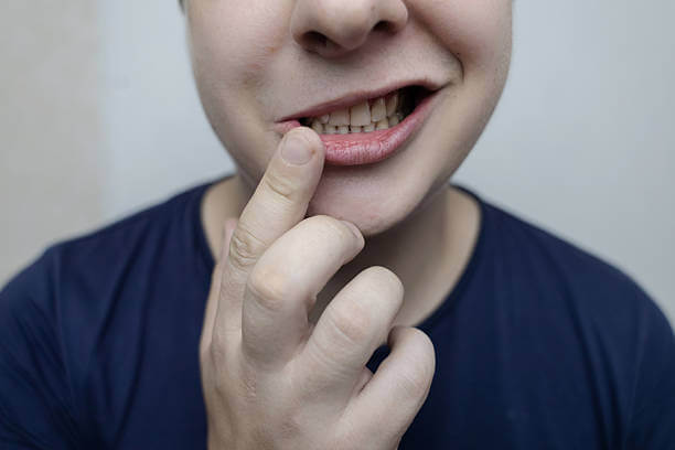 벨마비 재발률은? 안면마비 재발 위험을 줄이는 효과적인 방법!