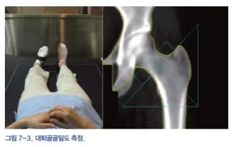 골밀도 검사 수치 골밀도 높이는 방법 간단 정리_8