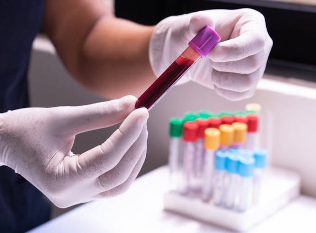 고지혈증에 좋은음식 및 고지혈증 증상