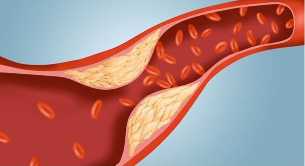 혈관청소에 좋은 음식