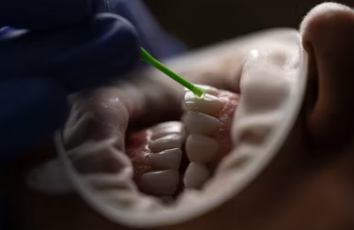 틀니 가격 의료보험적용 세척방법 보관법 종류