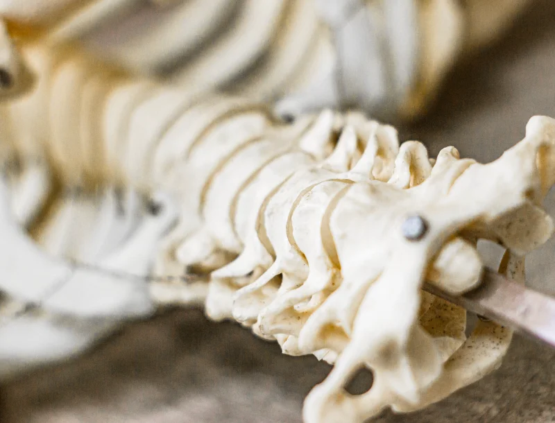 마판증후군 증상