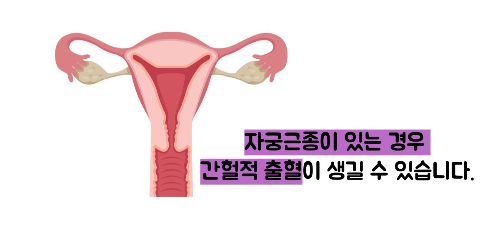 부정출혈 원인