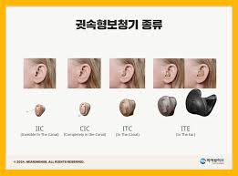 보청기-종류-가격-보조금-귀걸이형-귓속형-삽입형