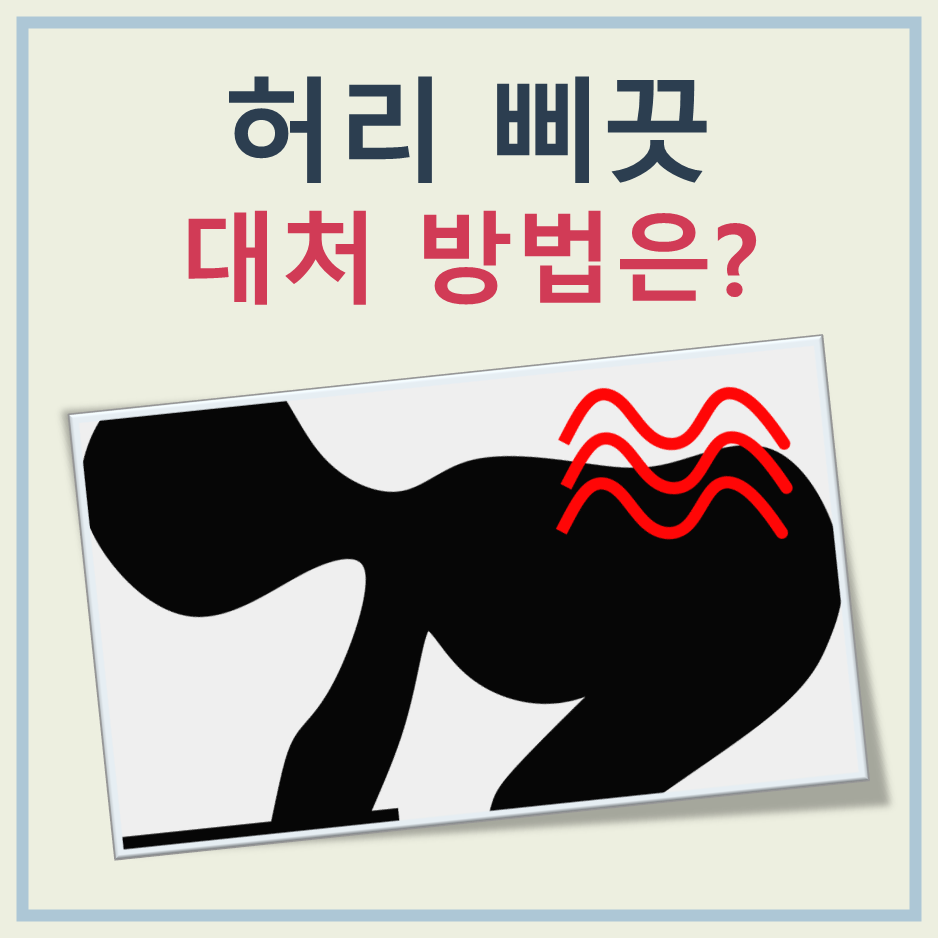 허리 삐끗했을때 대처 방법