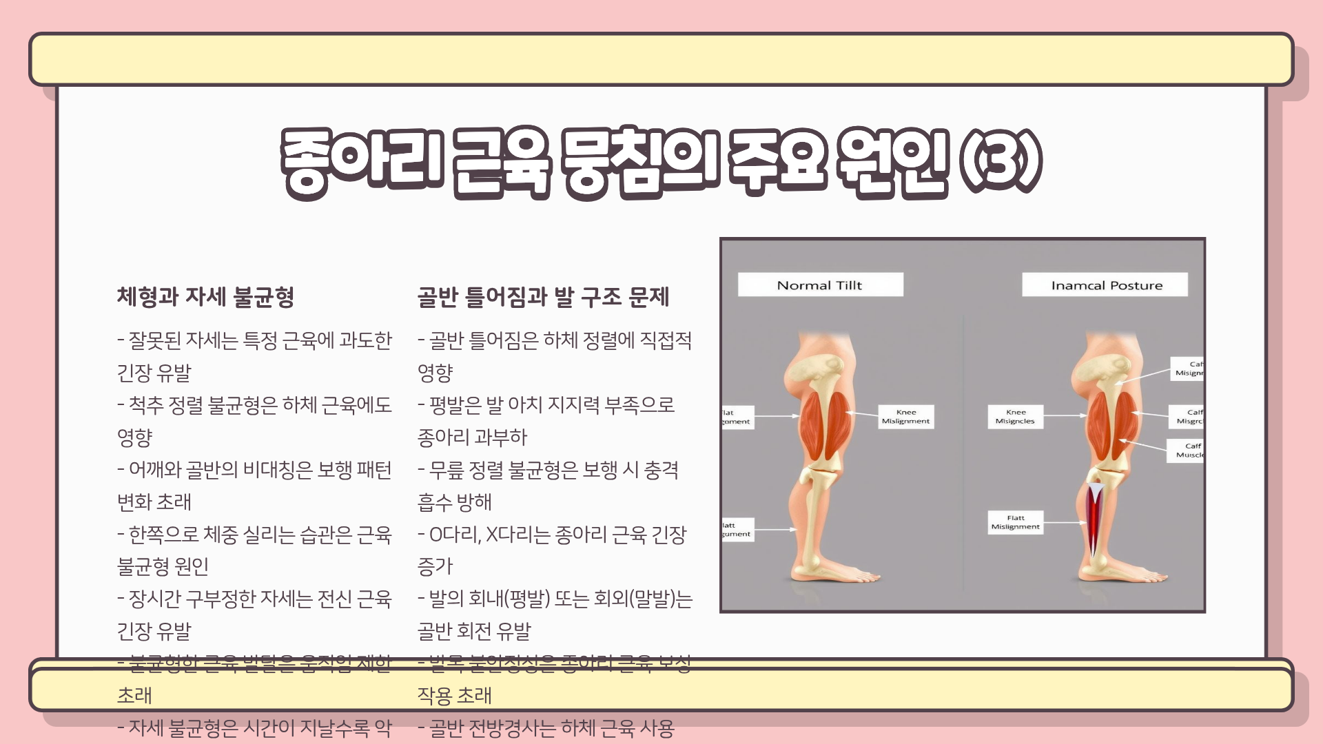 종아리 근육 뭉침 원인 ❘ 종아리 근육 뭉침 풀기 ❘ 종아리 근육 뭉침 해결 모두 총정리
