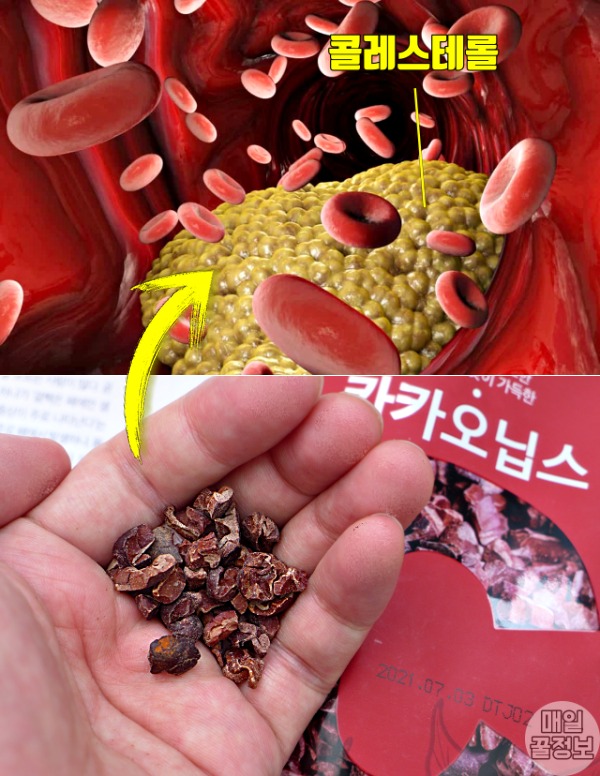 탁해진 피 고지혈증에 좋은 음식 카카오닙스 효능,팁줌