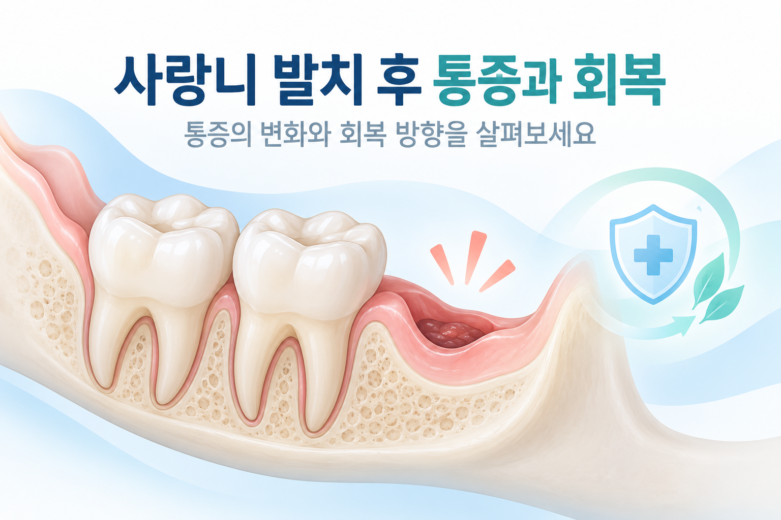 사랑니 발치 후 통증과 잇몸 회복 과정을 설명하는 치과 의료 일러스트