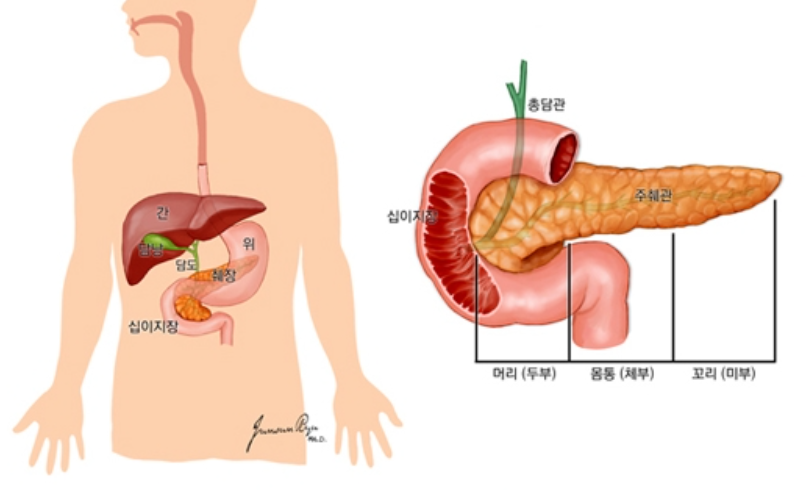 췌장 위치