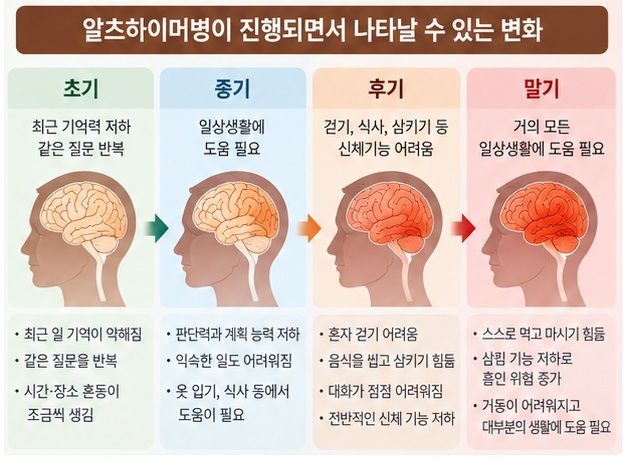 알츠하이머병이 진행되면서 걷기 식사 삼키기 기능이 어려워지는 과정을 설명한 인포그래픽