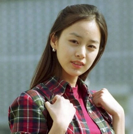 임플란트 후 교정 김태희 수지 효과