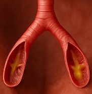 가래가 생기는 원인