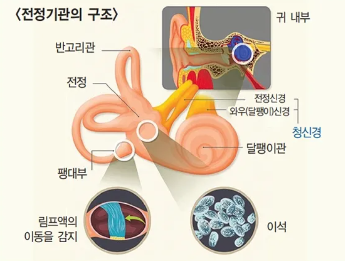 어지럼증 혹시 이석증? 어지럼증 원인과 증상