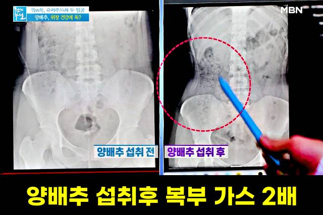 위에좋은음식 양배추 먹으면 안되는 사람 양배추먹는법 양배추 생으로 먹으면