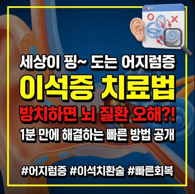 이석증 증상 치료법
