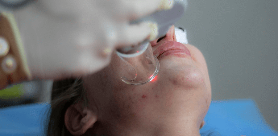 여드름이 나 있는 모습 - 7