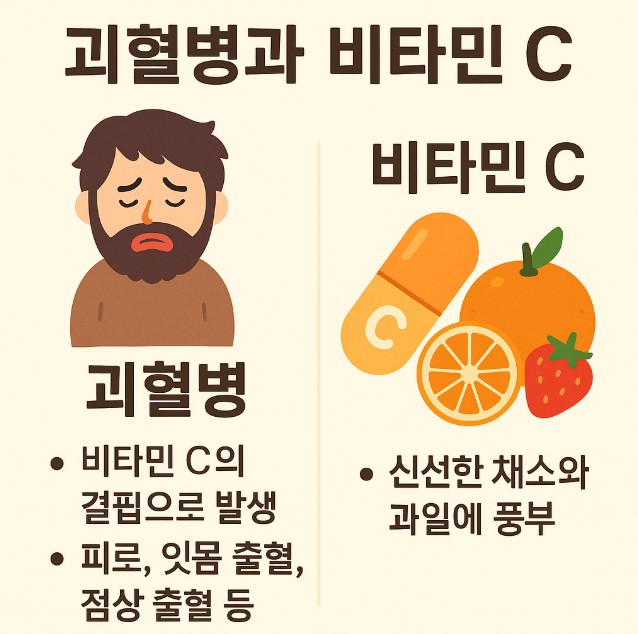 괴혈병과 비타민C 치료 관련 사진
