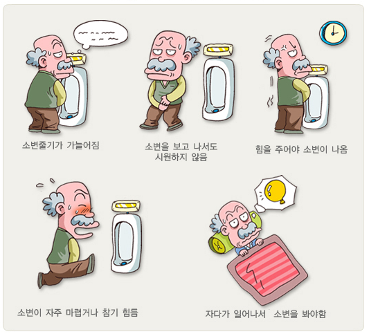 전립선비대증-주요-증상