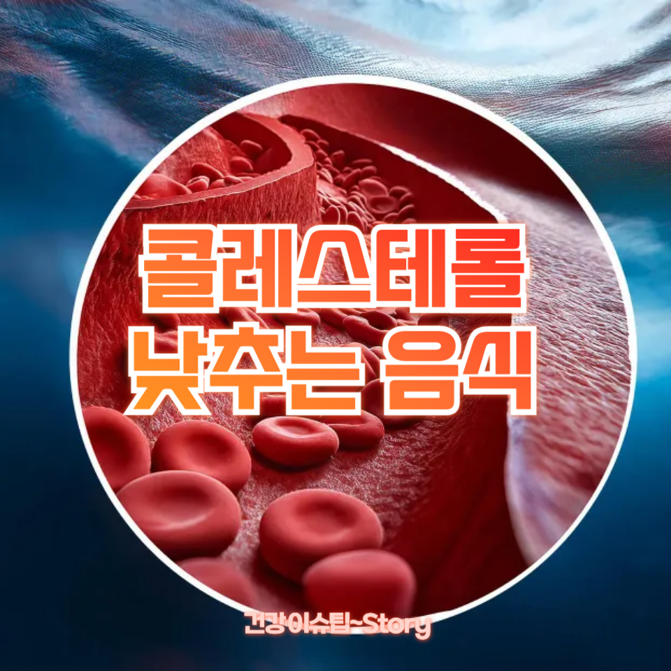 콜레스테롤 낮추는 음식
