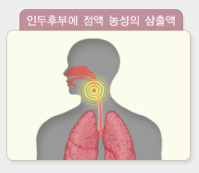 성홍열 증상 검사 전염 격리기간 총정리