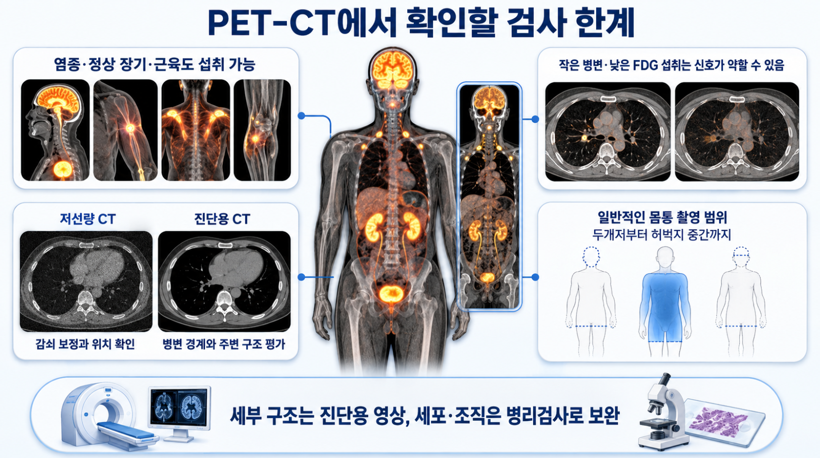 염증과 정상 조직의 섭취, 약한 병변 신호, 저선량 CT와 촬영 범위 등 PET-CT 검사 한계를 설명한 이미지