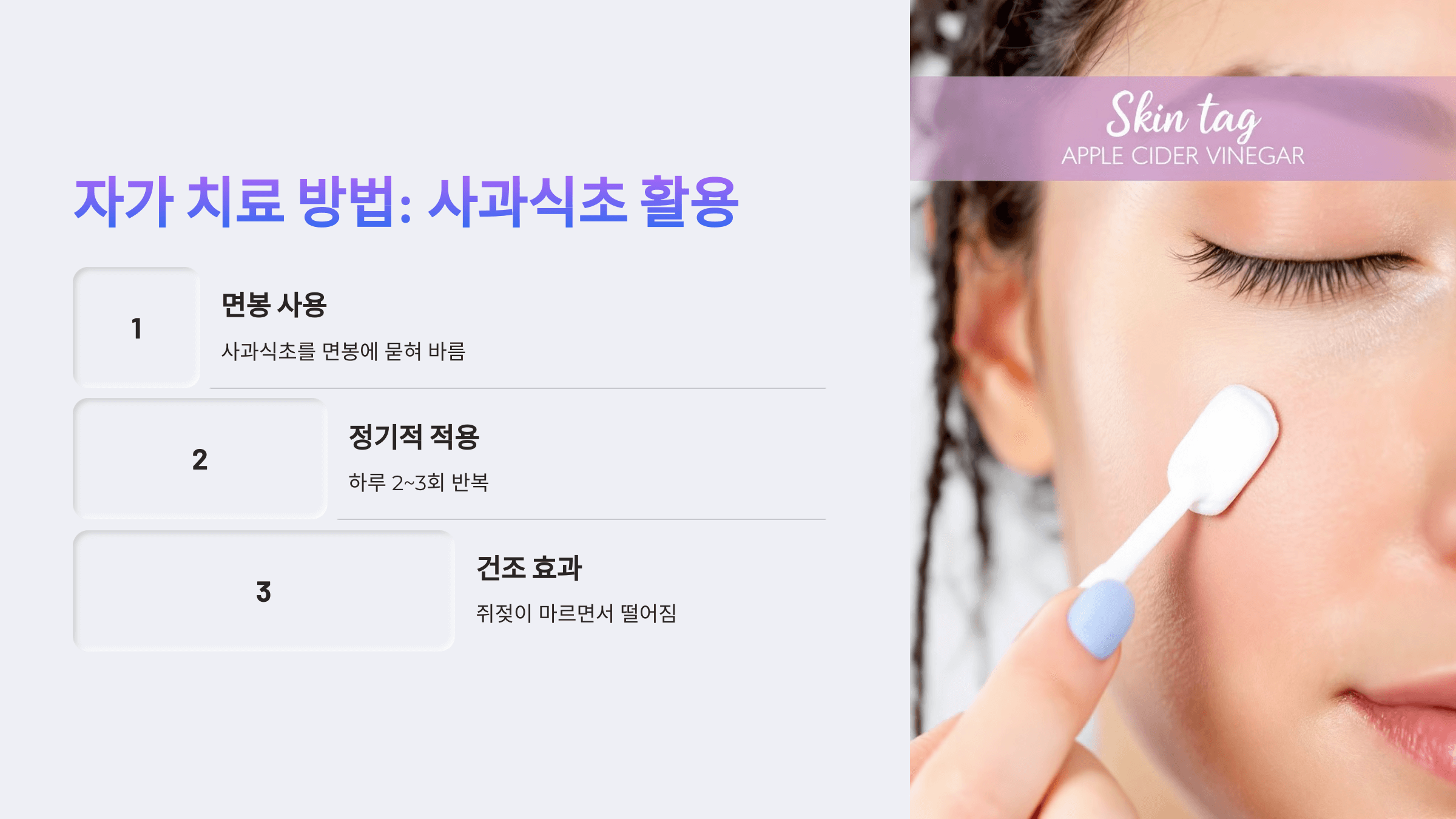 쥐젖과 관련된 사진입니다.