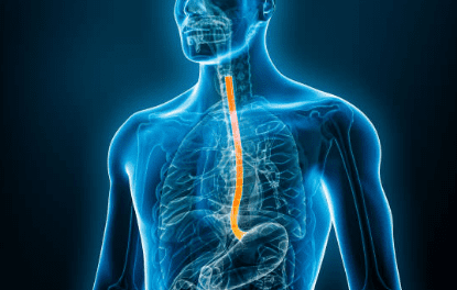 역류성 식도염 증상 10가지, 자연치료 방법