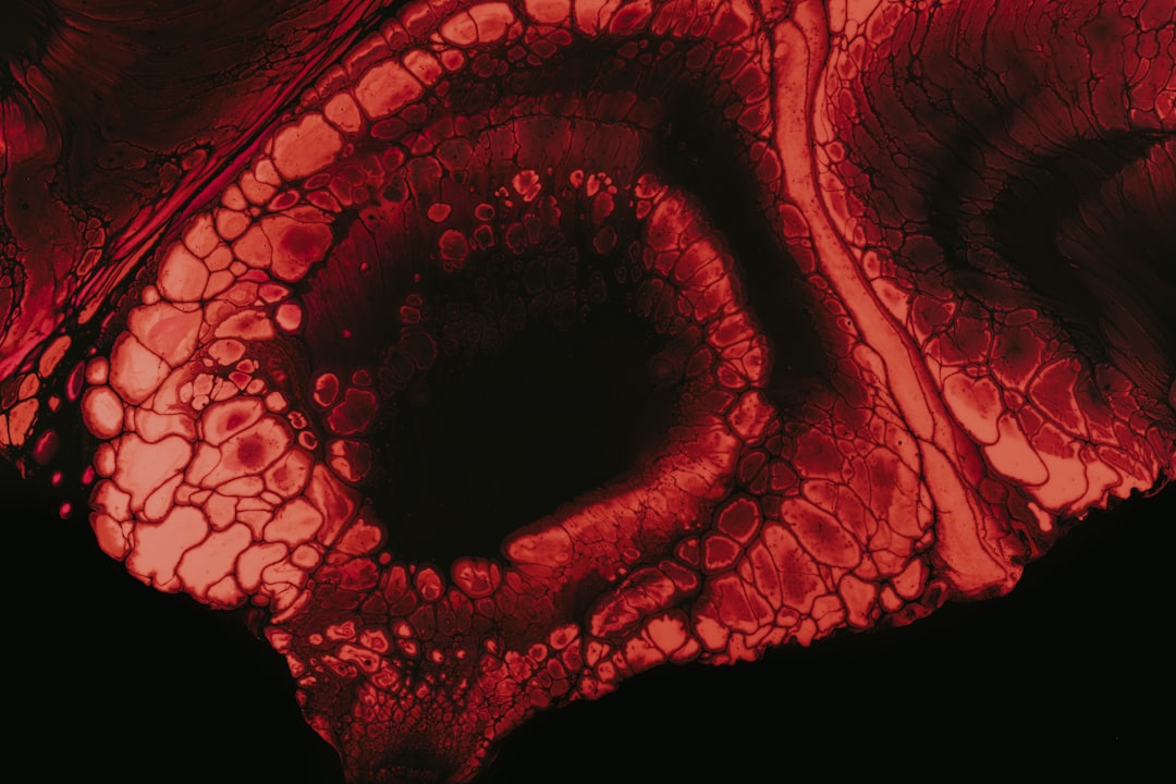 Gallbladder