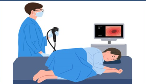 대장내시경 하는 이미지