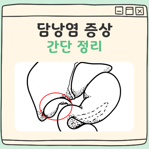 담낭염 증상 대표 이미지