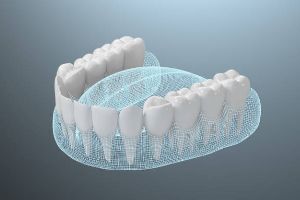 용인시-처인구-임플란트-치과-가격-비용-싼-곳,저렴한-곳,잘하는-곳,유명한-곳-BEST20-추천14