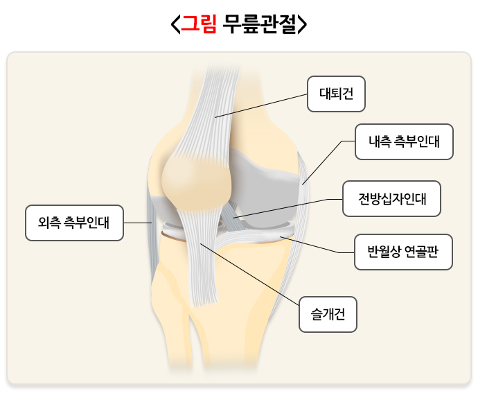 무릎관절 사진