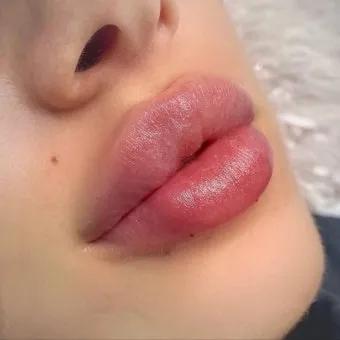 입술 밑 점 관상 참고 정보_18