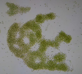 남세균의 한 종류인 마이크로시스티스의 현미경 사진