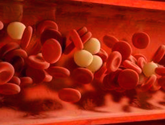 동맥경화증 초기증상