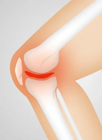 무릎-관절-통증