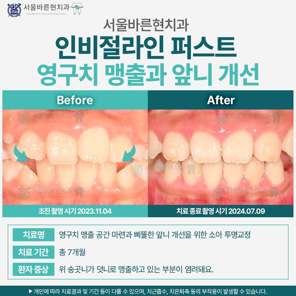 해운대인비절라퍼스트