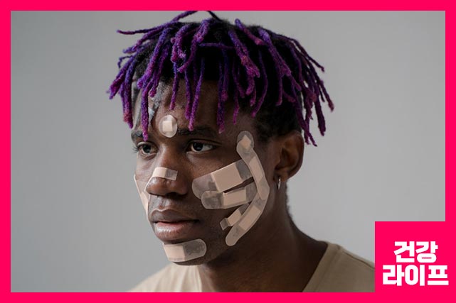 자외선 피부 노출이 원인