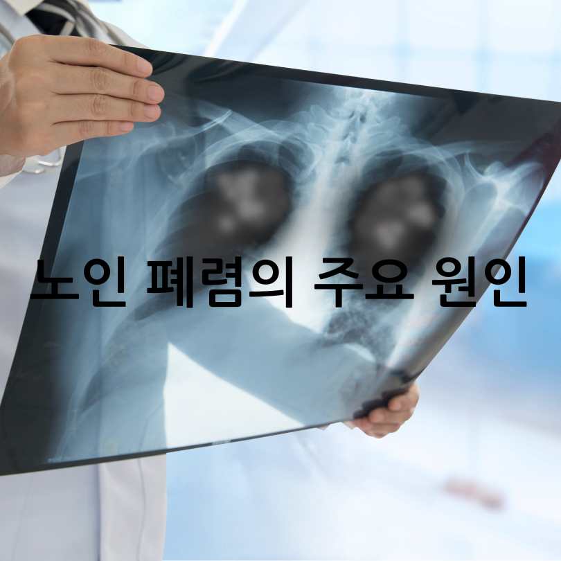 노인 폐렴 증상과 대처법