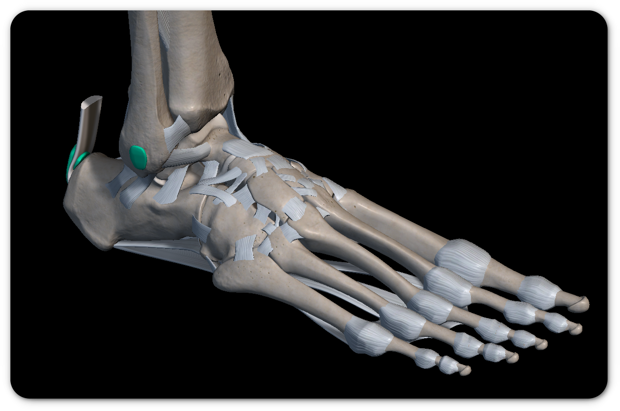 발목 염좌 증상