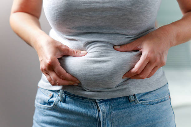 처진 뱃살 수술, 어떤 방법이 있을까? 효과와 부작용까지 자세히 정리