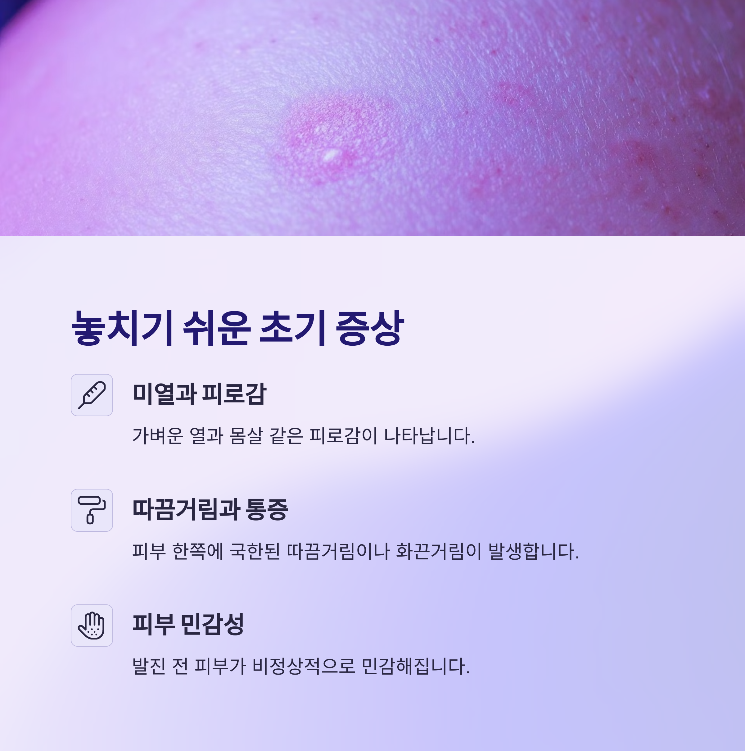 대상포진 초기 증상부터 치료·회복 음식까지 총정리