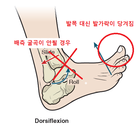 족저근막염과 배측굴곡