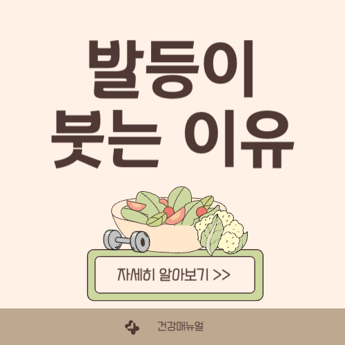 발등이 붓는 이유, 발등이 부어오르는 이유 알아보기