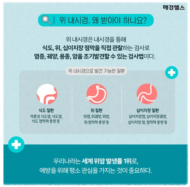 위내시경이란?