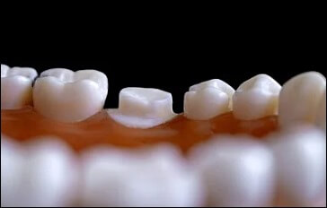 잇몸이 붓는 이유 5