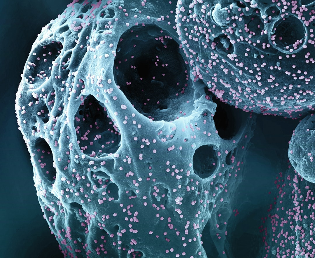Osteoporosis