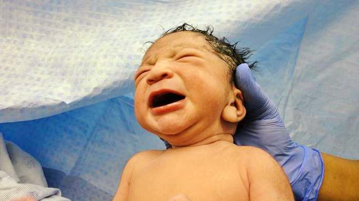 로타바이러스 증상 및 무료 예방접종 신청 및 백신 부작용 치료 방법